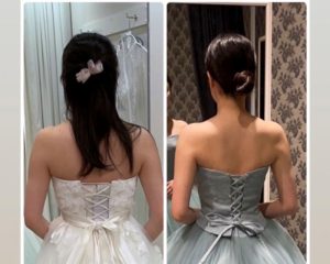 Before and after photos of back slimming treatment
