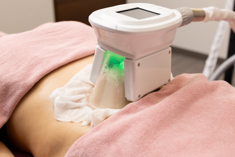 Frozen slimming